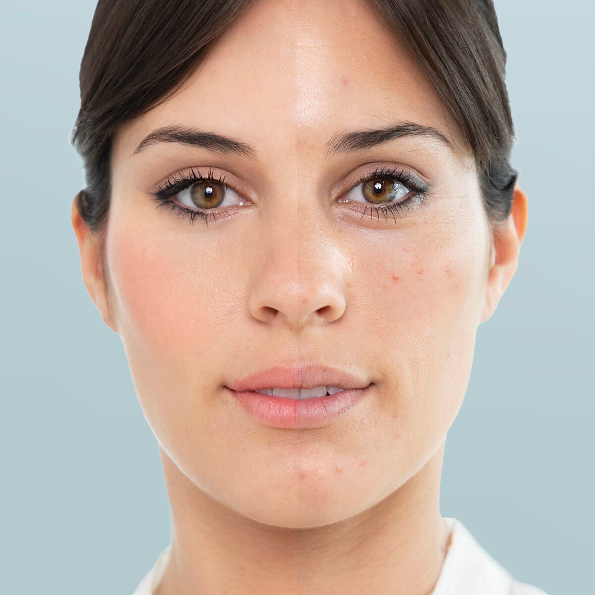 Sauna Facial y Limpiador de Puntos Negros